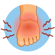 Bunion Pain
